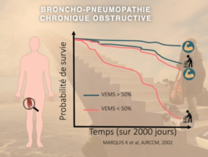 BPCO & Kinésithérapie - G. Prieur